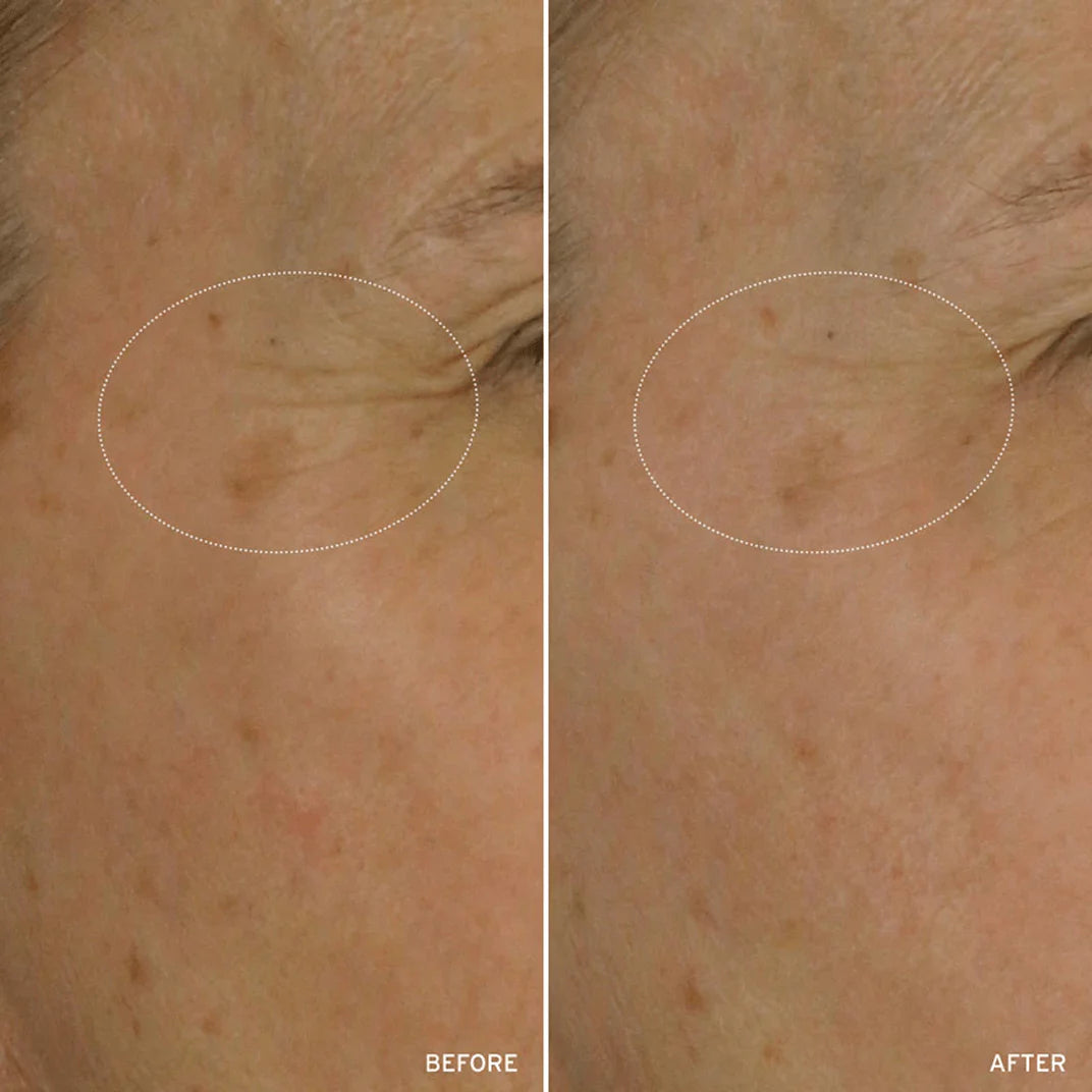 NAD+ CELL ENERGIZING TREATMENT